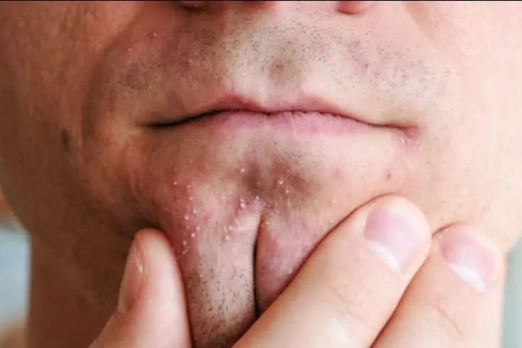 e2bea5fbc53dec1b25c95ad447f49ee0